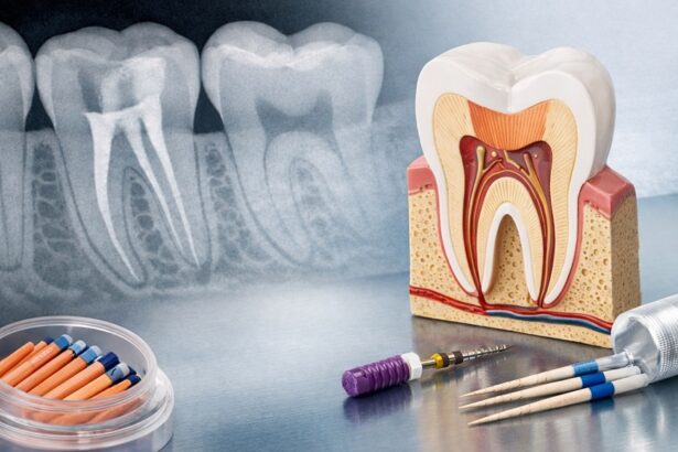Ενδοδοντική θεραπεία